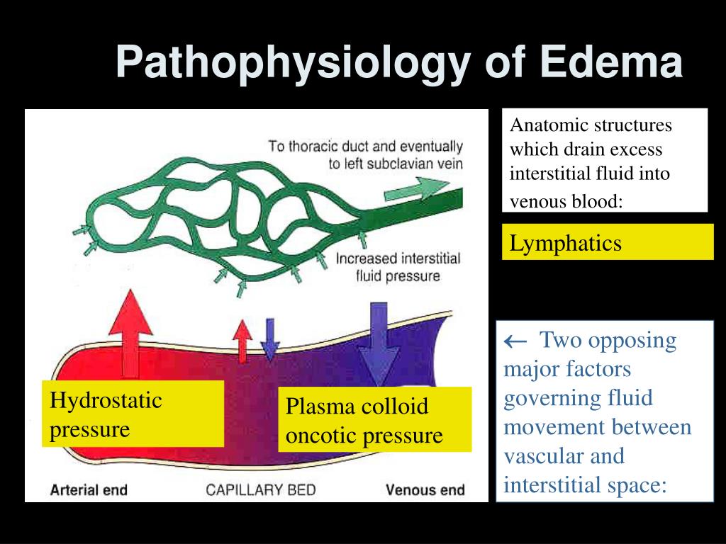 Pathophysiology Of Edema