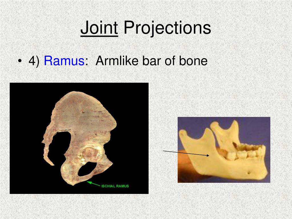 Appendicular Skeleton. Bones POWERPOINT. Join Project. Joined project