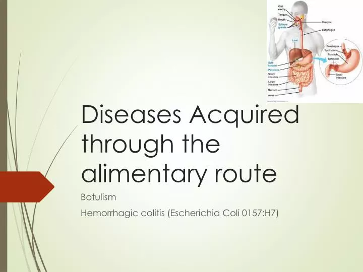 prepare a presentation about various diseases related with alimentary canal