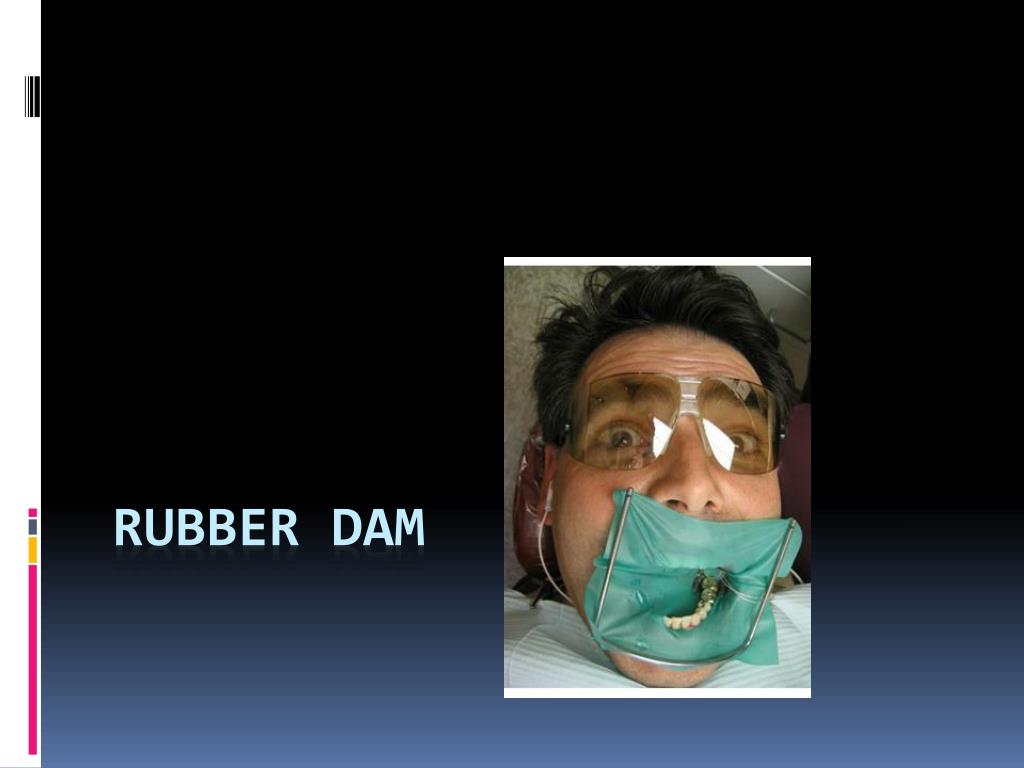 Rubber dam again – dropping a file - Dentistry