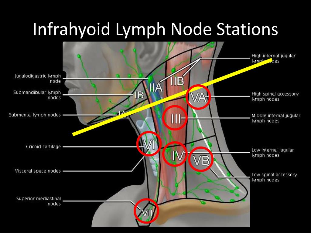 Cervical Lymph Node Stations News Current Station In The Word