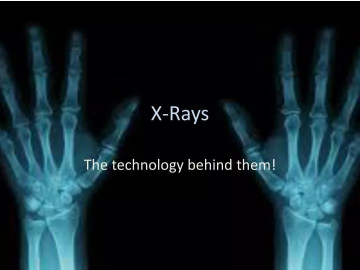 x ray presentation