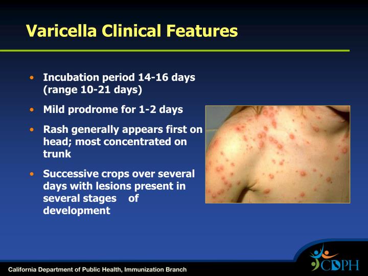 Valtrex Dosage For Shingles Outbreak