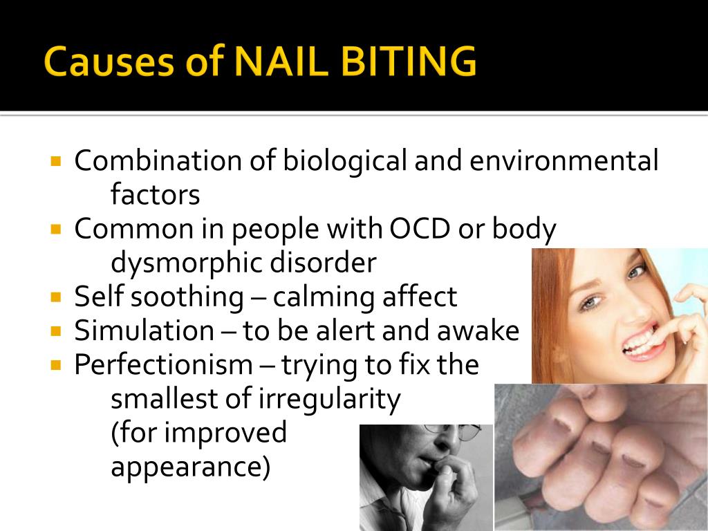 A solution for nail biting | Nail Salon Beautiful Nails by Linde