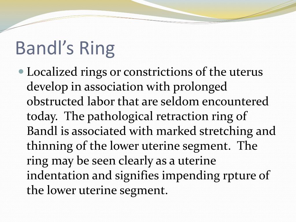 Bandles Ring Image | PDF