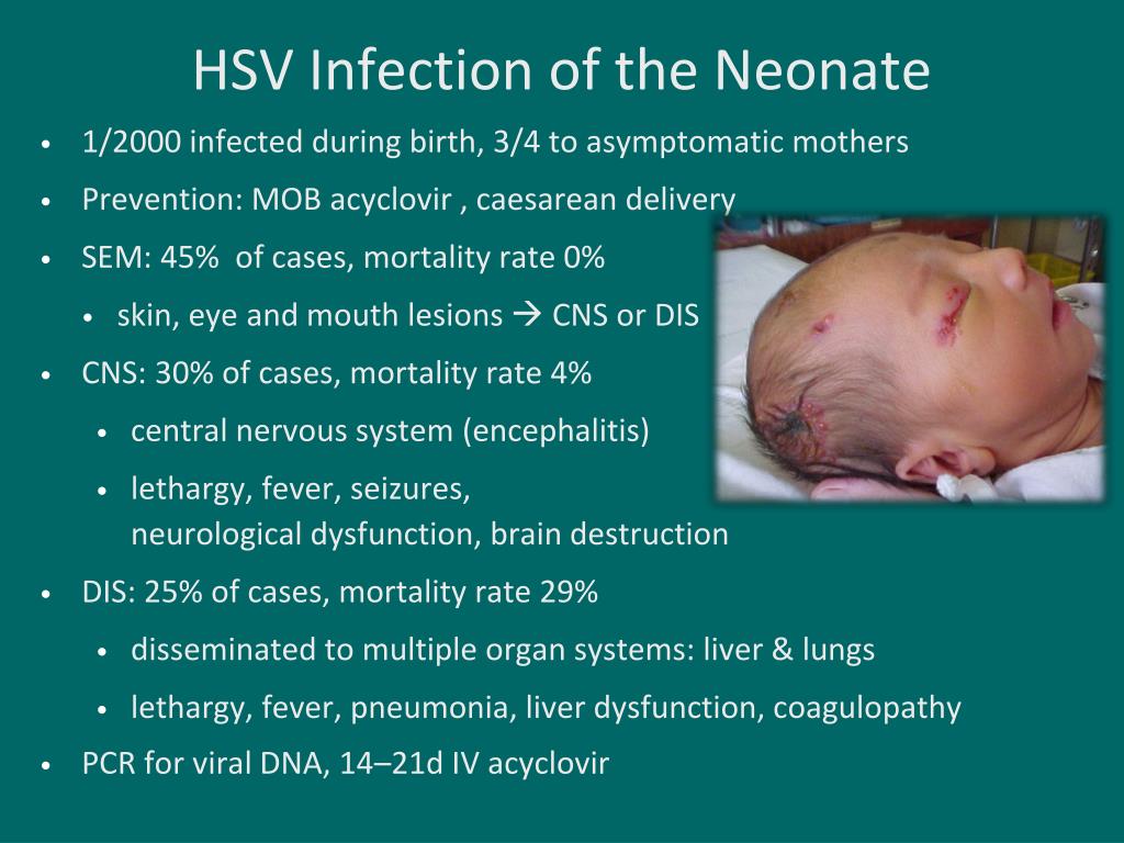 hsv presentation in neonates