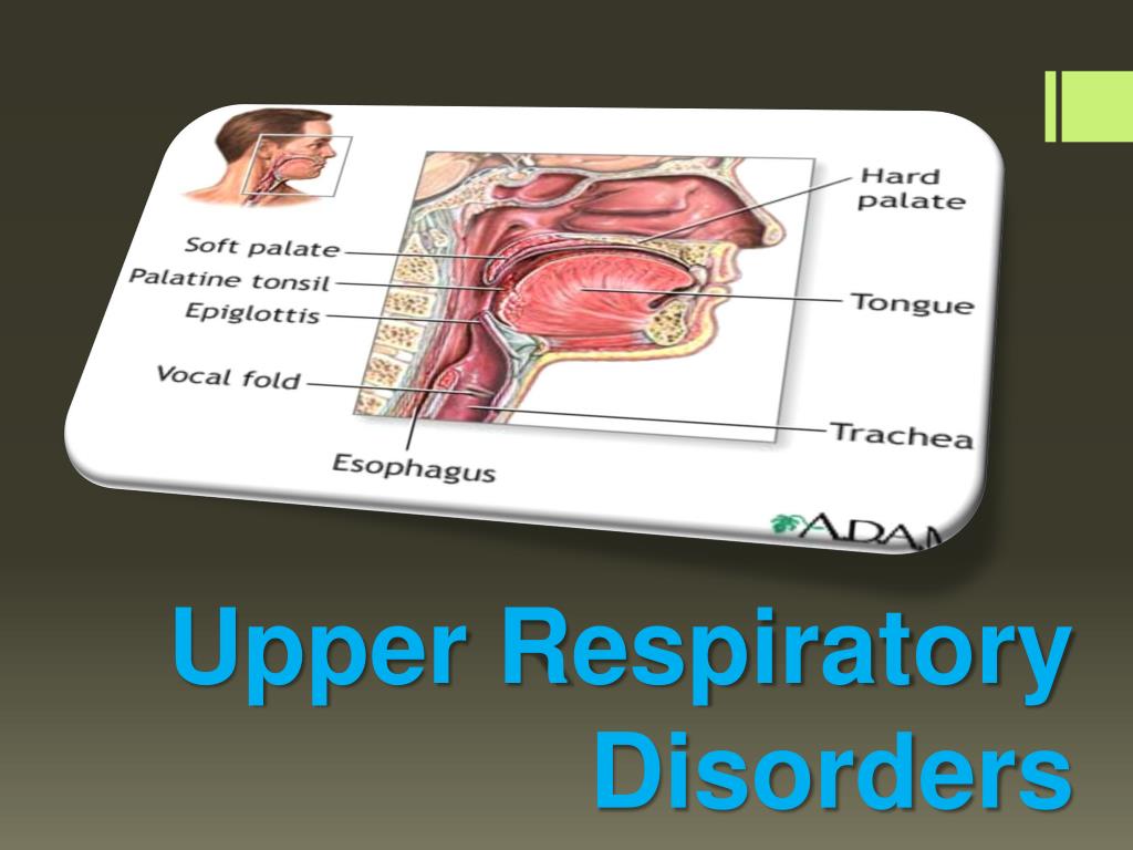 PPT DISORDERS OF THE UPPER AIRWAY PowerPoint Presentation, free