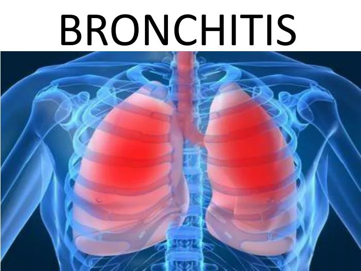 Ppt Bronchitis Powerpoint Presentation Free Download Id 1857430