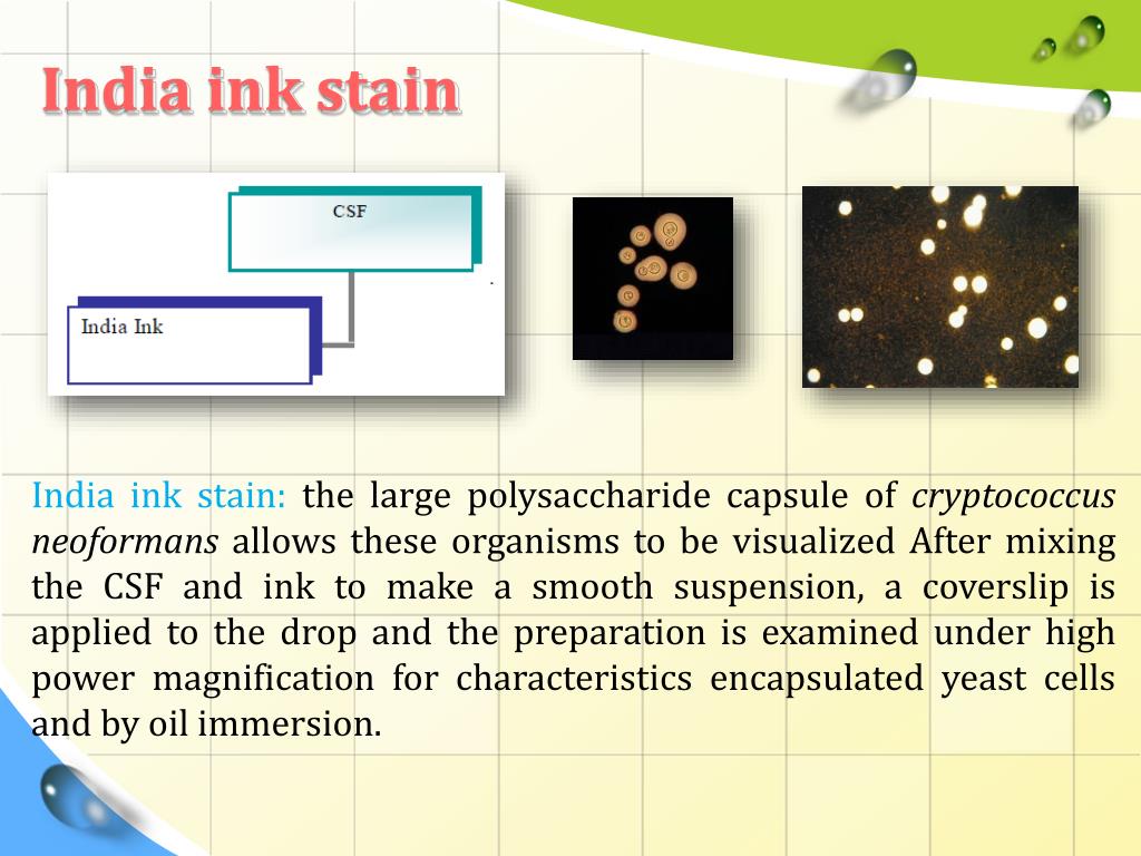india ink negative stain india ink negative stain
