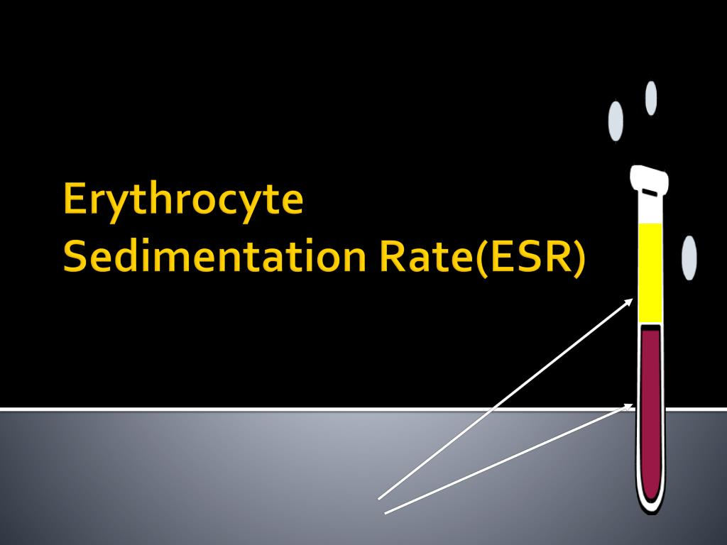 Erythrocyte Sedimentation Rate, ESR, What does ESR test show?