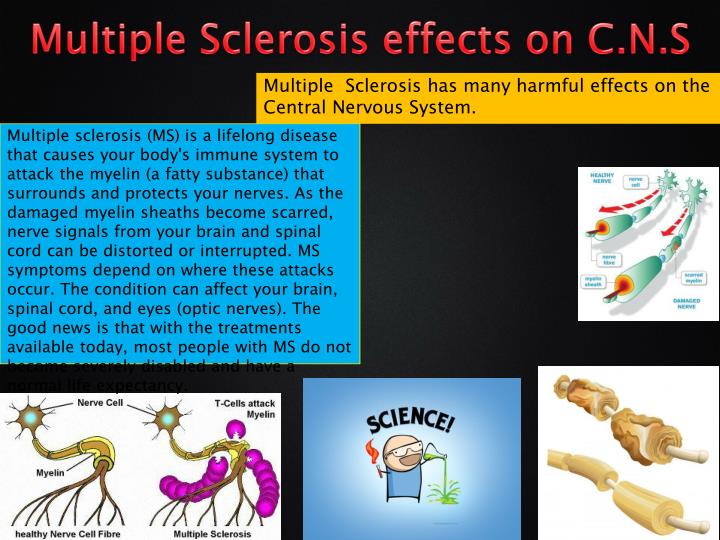 Ppt - Multiple Sclerosis Powerpoint Presentation - Id:1867144