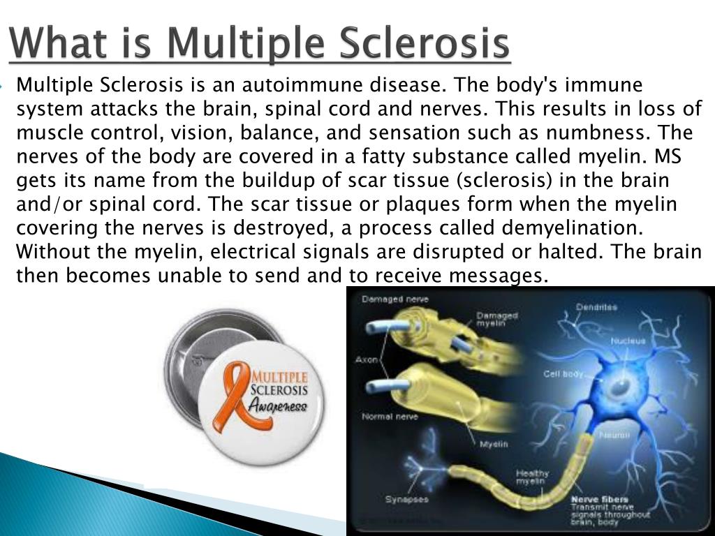 Ppt multiple sclerosis powerpoint presentation free download id
