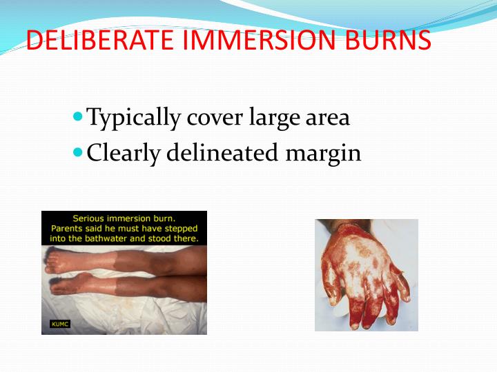 PPT - Child Abuse Investigation: Forensic Issues PowerPoint ...