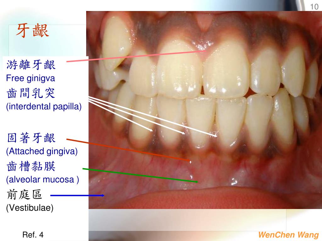 PPT - Oral Mucosa & Salivary Gland 口腔黏膜及唾液腺 PowerPoint Presentation ...