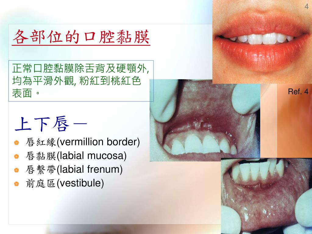 PPT - Oral Mucosa & Salivary Gland 口腔黏膜及唾液腺 PowerPoint Presentation ...