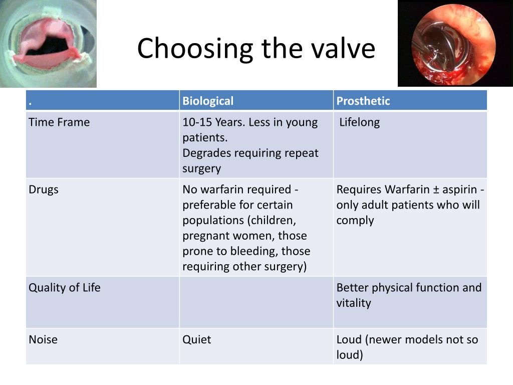 PPT Treatment of Infective Carditis and Rheumatic Heart Disease