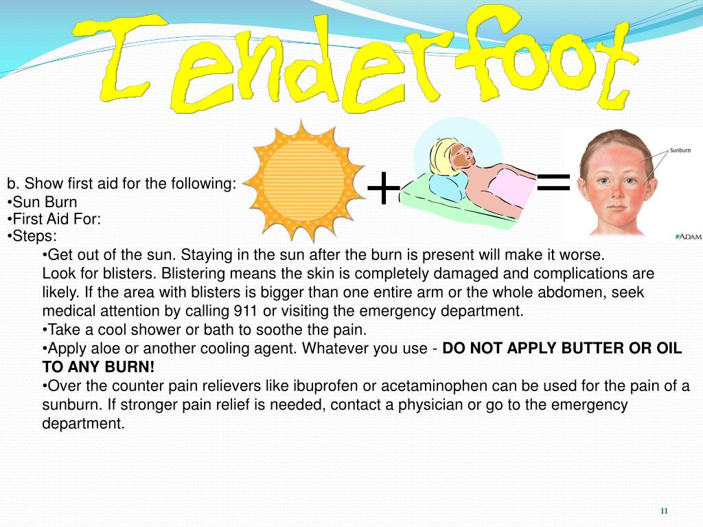 PPT Tenderfoot Requirement 12 a. Demonstrate how to care for someone