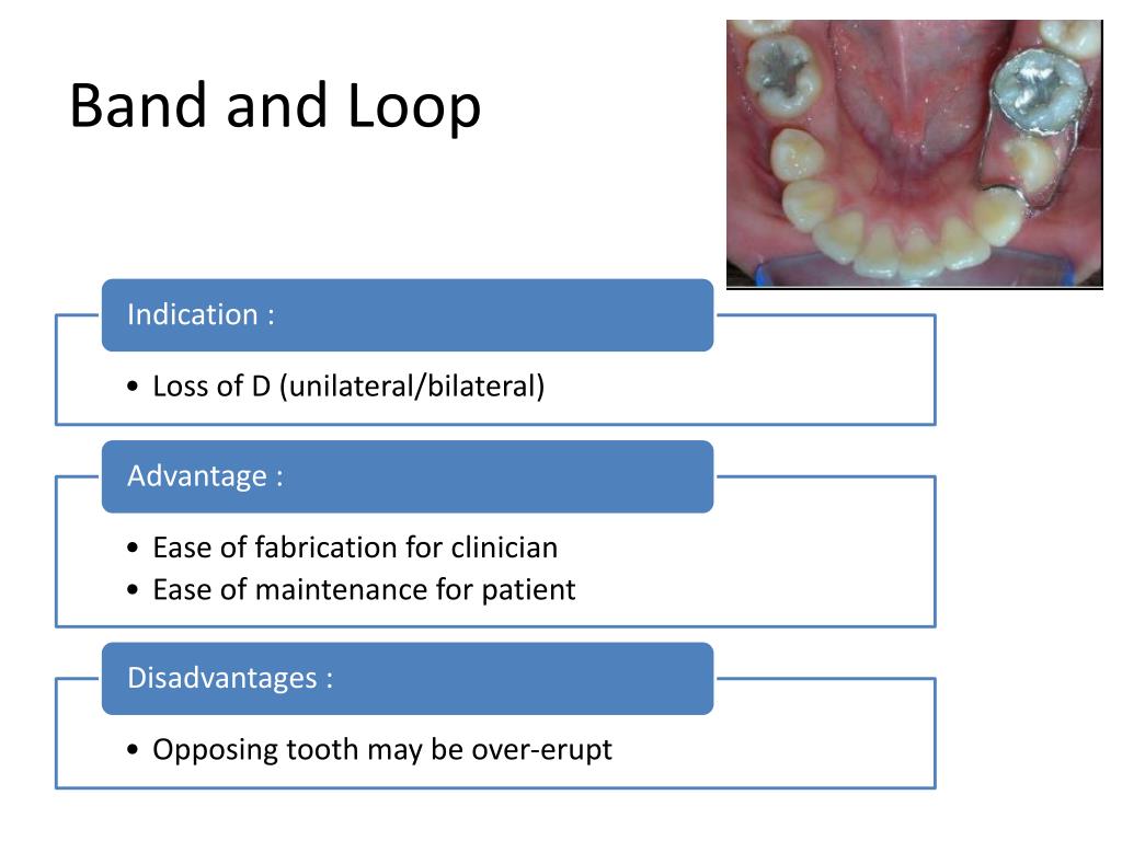 PPT ORTHODONTICS SEMINAR PowerPoint Presentation, free download ID