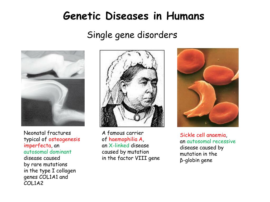 Human disease. Genetic diseases.