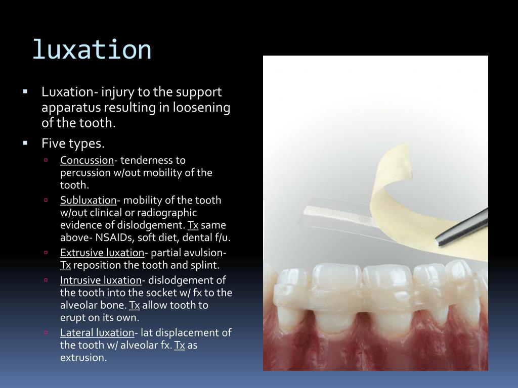 PPT Oral dental emergencies PowerPoint Presentation, free download