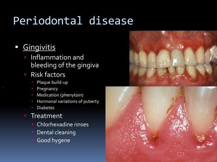 PPT Oral dental emergencies PowerPoint Presentation ID1880246