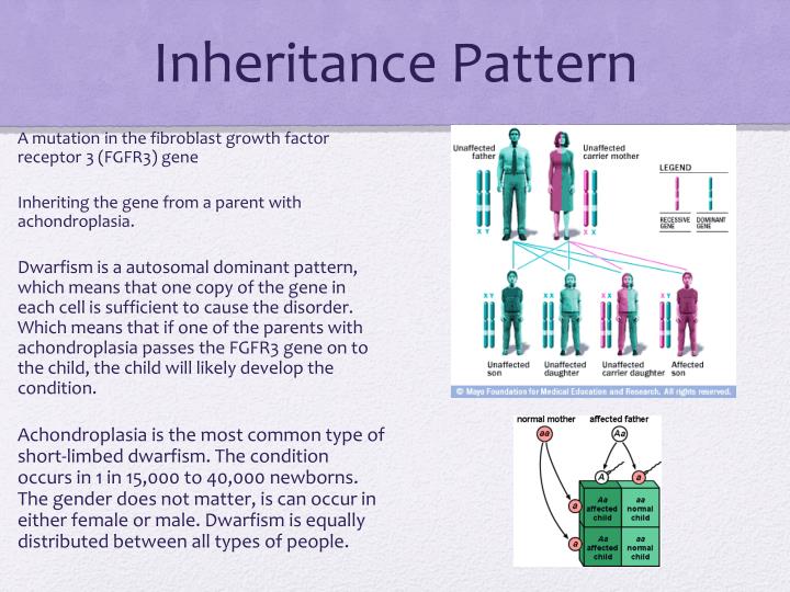 Ppt Dwarfism Powerpoint Presentation Id 1885711