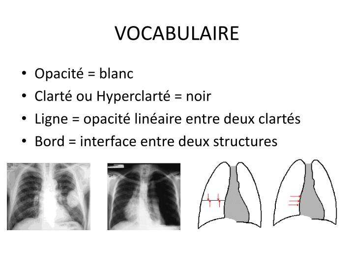 PPT - RADIOGRAPHIE & ECHOGRAPHIE Bases techniques Sémiologie générale ...