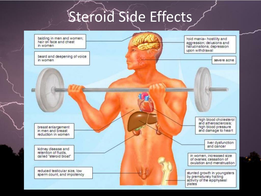 steroid-side-effects-l.jpg