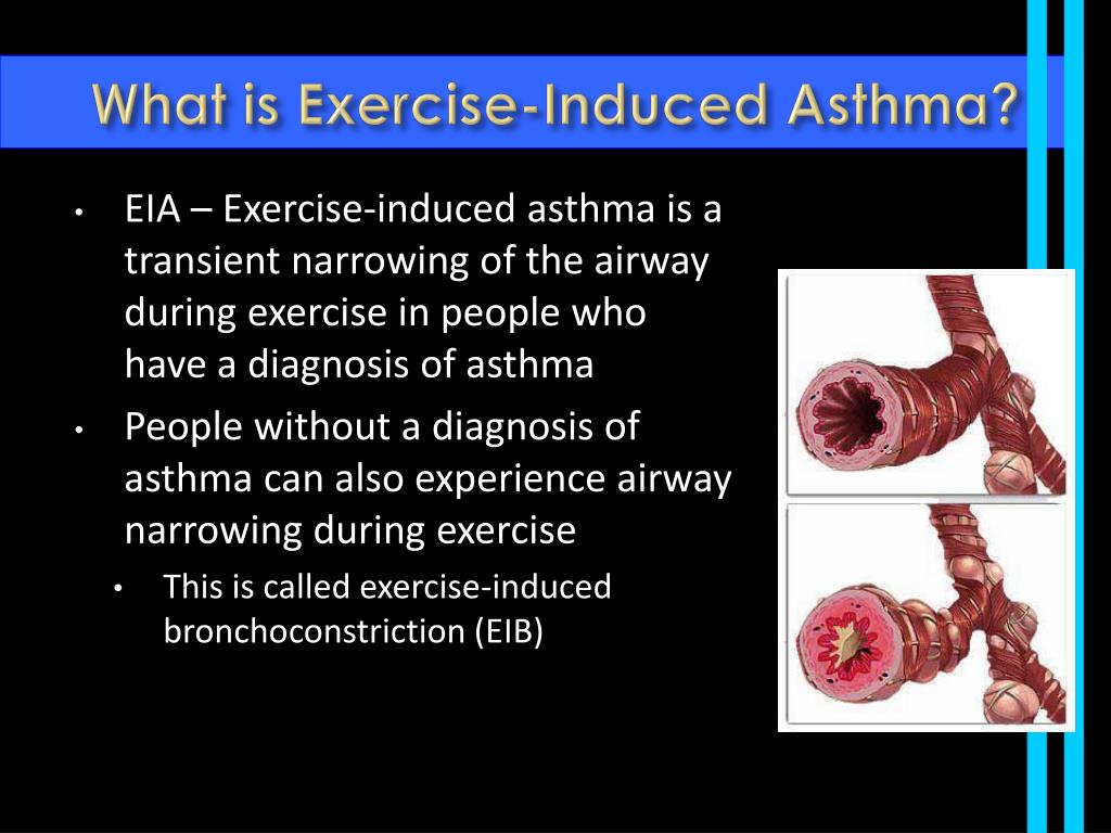 exercise induced asthma essay