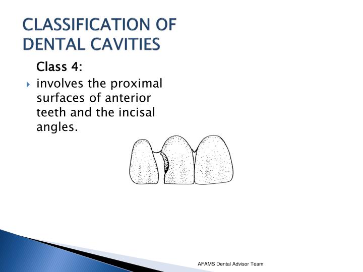 PPT - CLASSIFICATION OF DENTAL CAVITIES, PREPARATIONS AND RESTORATIONS ...