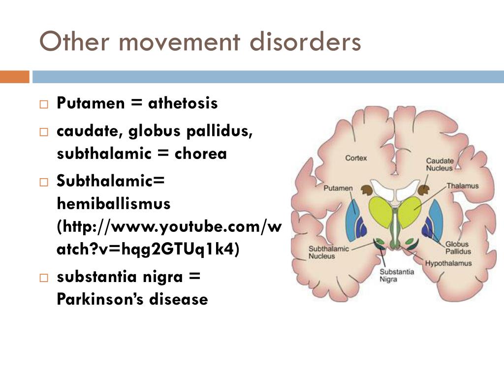 Что такое путамен 8 букв. Putamen. Гемихорея гемибаллизм. Гемибаллизм неврология. Movement Disorders.
