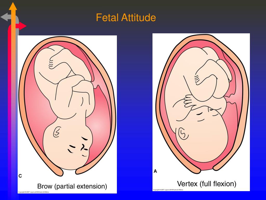 a presentation of fetus