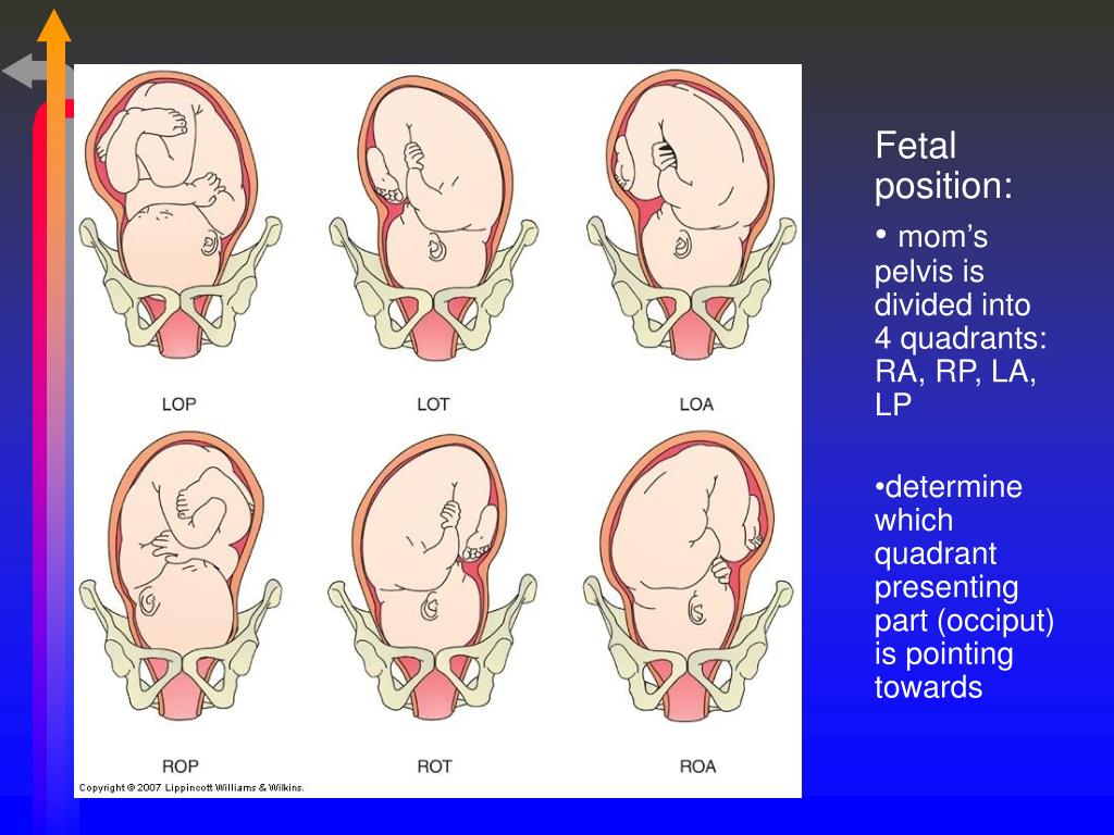 fetal presentation slideshare