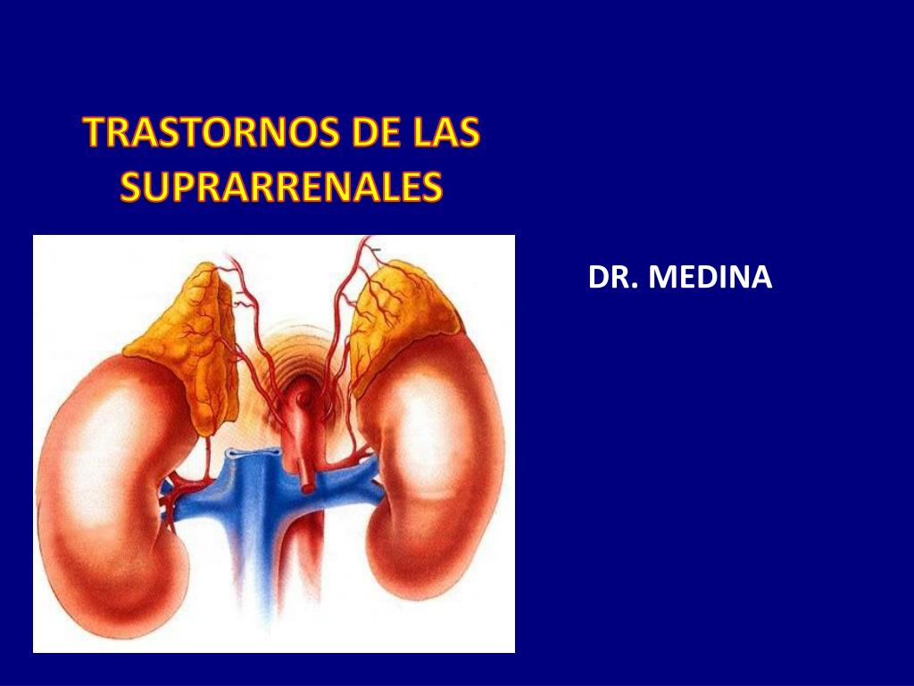 PPT - TRASTORNOS DE LAS SUPRARRENALES PowerPoint Presentation, free  download - ID:1898651