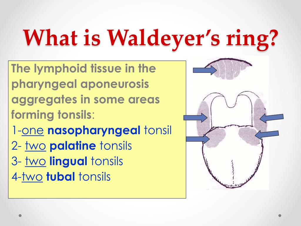 Representative histopathological features of Waldeyer's ring... | Download  Scientific Diagram