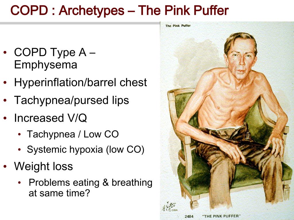 احتفال دعامة ي يحصن يقوى بند why is emphysema called pink puffer -  dsvdedommel.com