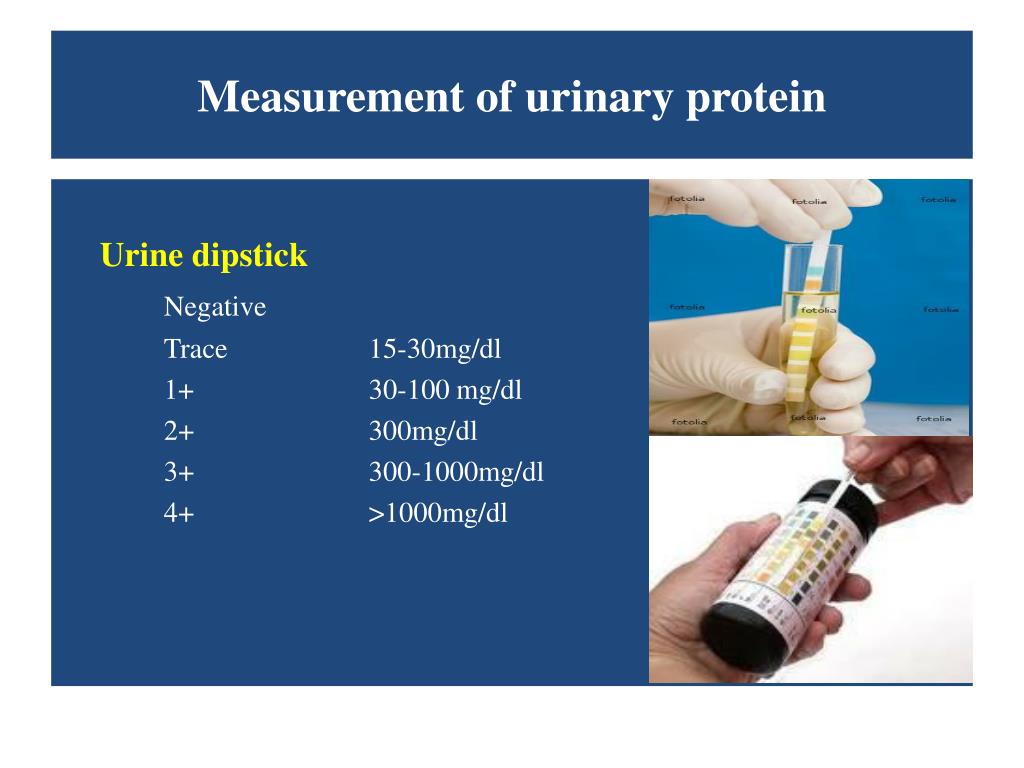 PPT PROTEINURIA AND HEMATURIA PowerPoint Presentation