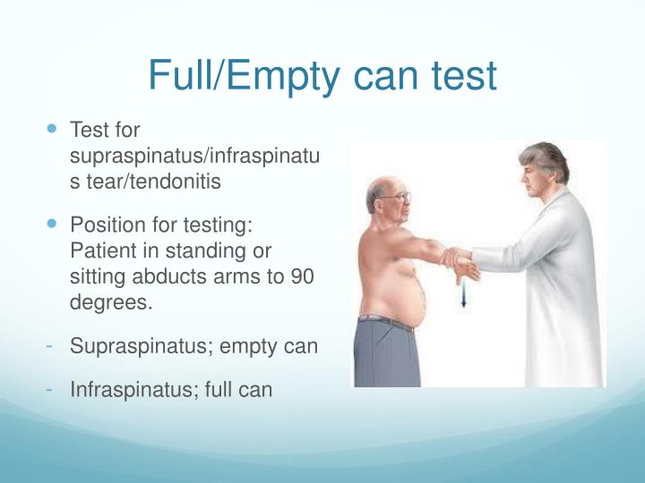 PPT GP LECTURE SERIES 2013 THE SHOULDER Assessment Treatment And PPT GP LECTURE SERIES 2013 THE SHOULDER Assessment Treatment And