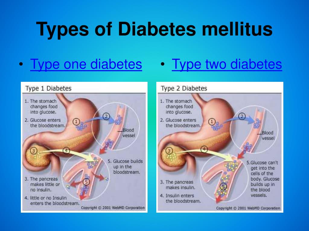 ppt presentation of diabetes mellitus