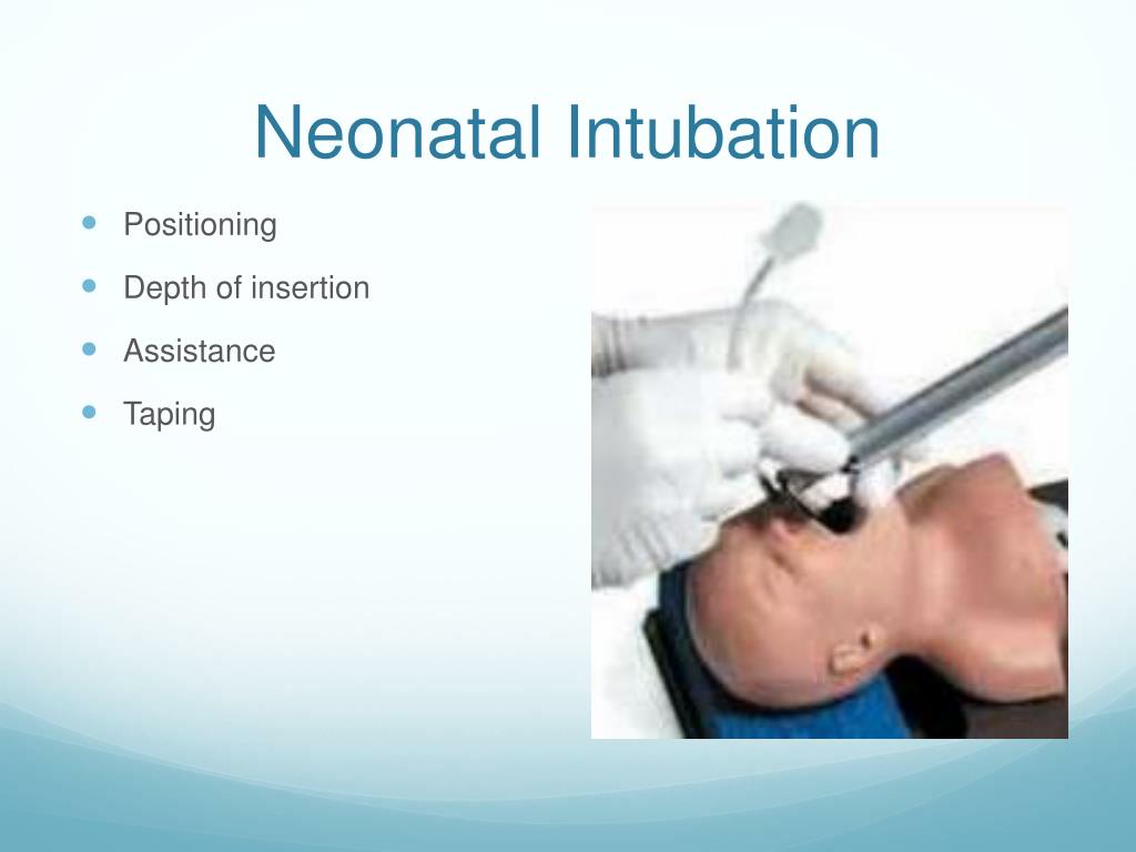 rapid sequence intubation neonatal