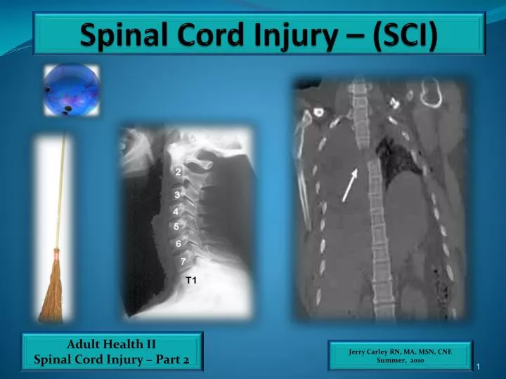 spinal cord injuries essay In addition, the clinic is conducting research utilizing non-invasive brain stimulation in conjunction with robotics therapy the researchers are working with patients with neurological disease causing upper body immobility and paralysis caused by stroke, spinal cord injury and traumatic brain injury. spinal cord injuries essay In addition, the clinic is conducting research utilizing non-invasive brain stimulation in conjunction with robotics therapy the researchers are working with patients with neurological disease causing upper body immobility and paralysis caused by stroke, spinal cord injury and traumatic brain injury.