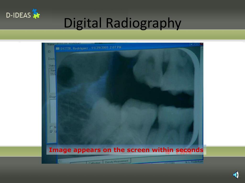 PPT Infection Control in Dental Radiology PowerPoint Presentation