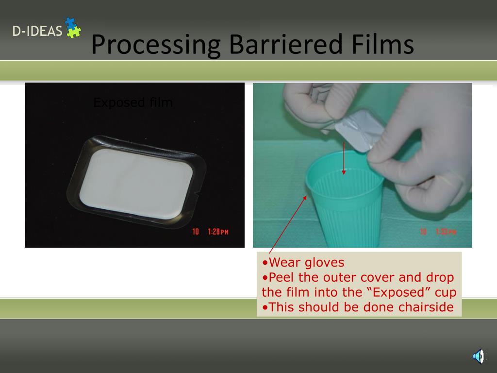 PPT Infection Control in Dental Radiology PowerPoint Presentation