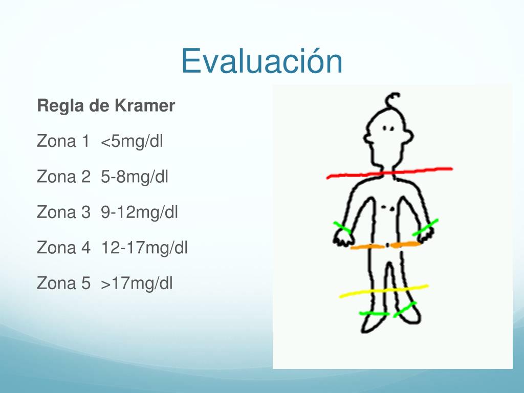 PPT Ictericia Neonatal PowerPoint Presentation Free Download ID