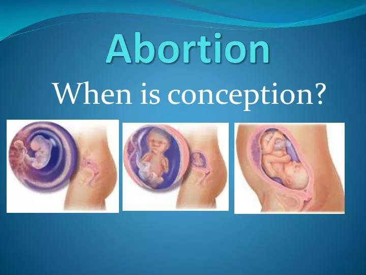 thesis of abortion Get to know how to write thesis statement for abortion research paper. thesis of abortion Get to know how to write thesis statement for abortion research paper.