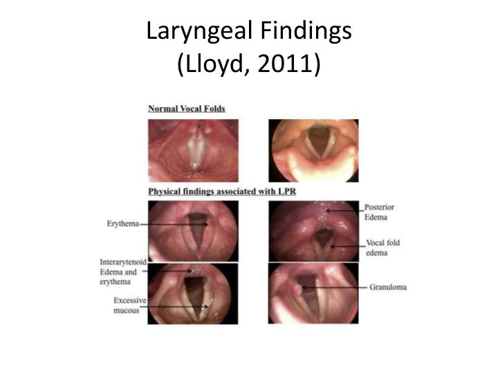 PPT Treatment Strategies for Voice Disorders Associated with