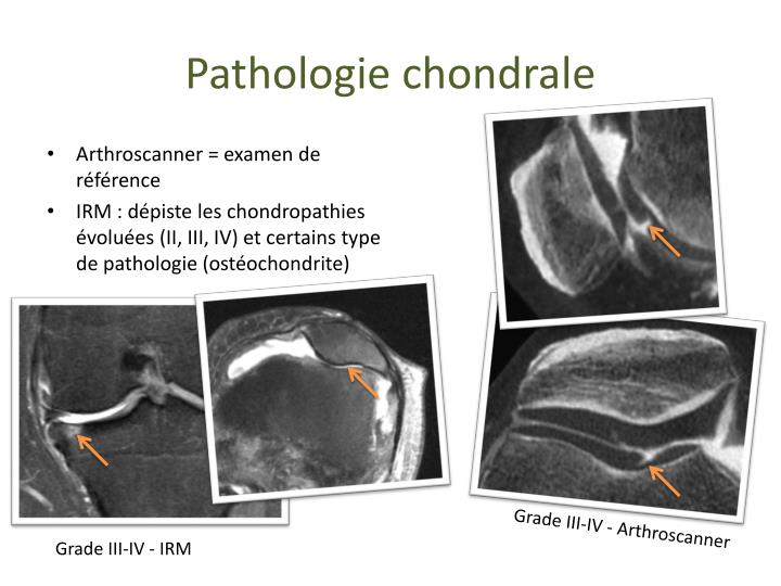 PPT Imagerie du genou pour le rhumatologue PowerPoint Presentation — free download