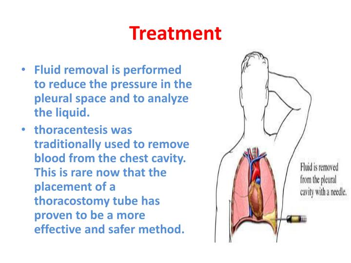 PPT - Pleura t ypes PowerPoint Presentation - ID:1921428