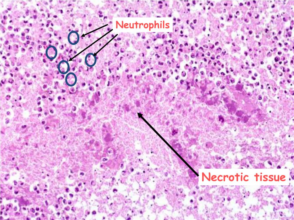 PPT Cell Injury 3 PowerPoint Presentation Free Download ID 1930325 PPT Cell Injury 3 PowerPoint Presentation Free Download ID 1930325