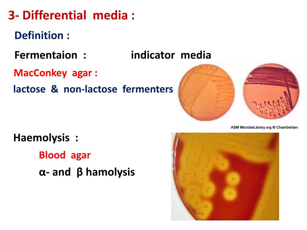 Haemolysis латынь. Synthetic Culture Media. The Media Definition. Reaction of Radial haemolysis photo.